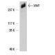 von Willebrand Factor/VWF Antibody (3E2D10) - Western Blotting - Image 6226