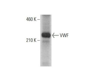 von Willebrand Factor/VWF Antibody (3E2D10) - Western Blotting - Image 352030 