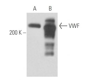 von Willebrand Factor/VWF Antibody (GMA-022) - Western Blotting - Image 16280