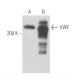 von Willebrand Factor/VWF Antibody (GMA-022) - Western Blotting - Image 16280