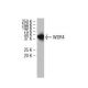 WDR4 Antibody (321.9) - Western Blotting - Image 34264