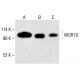 WDR70-Antikörper (C-5): sc-398268. Western Blot Analyse der WDR70 Expression in HeLa- (A), K-562- (B) und HCT-116- (C) Gesamtzelllysaten. Verwendetes Nachweisreagenz: m-IgG1 BP-HRP: sc-525408. WDR70 Antibody (C-5) - Western Blotting - Image 415391