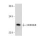 WEHI-231 Whole Cell Lysate: sc-2213. Western blot analysis of FAHD2A/B...