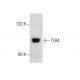 WEHI-231 Whole Cell Lysate: sc-2213. Western blot analysis of TLR4... 
