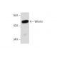 Whirlin Antibody (D-5) - Western Blotting - Image 134932 