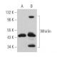 Whirlin Antibody (D-5) - Western Blotting - Image 367355 