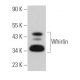 Whirlin Antibody (D-5) - Western Blotting - Image 367419