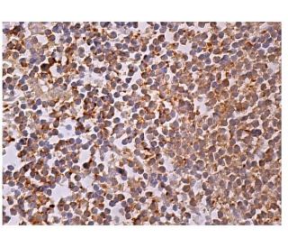 WIP Antibody (E-9) - Immunohistochemistry - Image 159997 