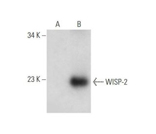 WISP-2 Antibody (B-5) - Western Blotting - Image 314527 