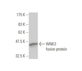WNK3 Antibody (4H5) - Western Blotting - Image 350274