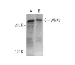 WNK3 Antibody (A-6) - Western Blotting - Image 351717