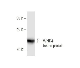WNK4 Antibody (1E6) - Western Blotting - Image 350273 