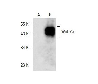 Wnt-7a/b Antibody (H-8) - Western Blotting - Image 141574SAM Transcription Activation: SAM system utilizing dCas9-VP64, MS2-P65-HSF1, and sgRNA for precise gene transcription activation.
