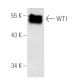 WT1 Antibody (F-6) - Western Blotting - Image 870