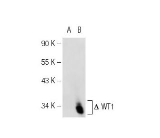 LEF-1 Antibody (2D12) - Western Blotting - Image 37138 