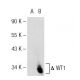 LEF-1 Antibody (2D12) - Western Blotting - Image 37138 