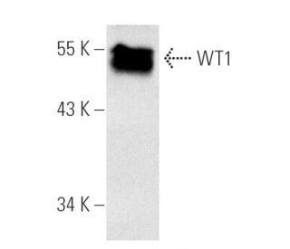 WT1 Antibody (F-6) - Western Blotting - Image 870 