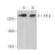 X11β Antibody (H-7) - Western Blotting - Image 369344 