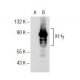 X11γ Antibody (32) - Western Blotting - Image 141356