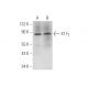 X11γ Antibody (H-6) - Western Blotting - Image 314219