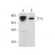 X11γ Antibody (H-6) - Western Blotting - Image 376420 