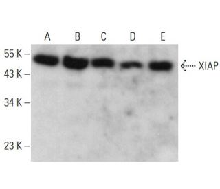 XIAP Antibody (E-2) - Western Blotting - Image 380655 