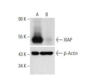 XIAP HDR Plasmid (h): sc-416497-HDR. Western blot analysis of XIAP expression in non-transfected control(A) and puromycin