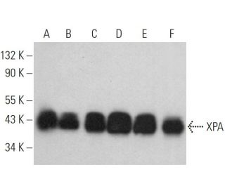 XPA Antibody (3H55) - Western Blotting - Image 357943 