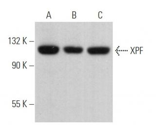 XPF Antibody (3F2/3) - Western Blotting - Image 363424 
