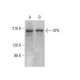 XPG Antibody (3C189) - Western Blotting - Image 378138 