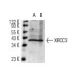 XRCC3 Antibody (10F1/6) - Western Blotting - Image 12795