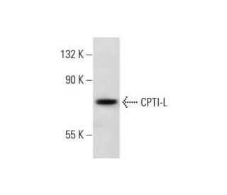 CPTI-L (H-95): sc-20669. Western blot analysis of CPTI-L expression in Y79 whole cell lysate. 