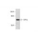 CPTI-L (H-95): sc-20669. Western blot analysis of CPTI-L expression in Y79 whole cell lysate. 