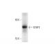 SENP3 (H-195): sc-67076. Western blot analysis of SENP3 expression in Y79 nuclear extract.