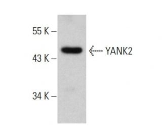 YANK2 Antibody (4A7) - Western Blotting - Image 385139 