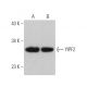 YIPF2 Antibody (A-10) - Western Blotting - Image 372398 