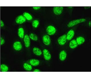 YT521-B Antibody (8) - Immunofluorescence - Image 381701 