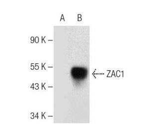 ZAC1 Antibody (F-9) - Western Blotting - Image 281773