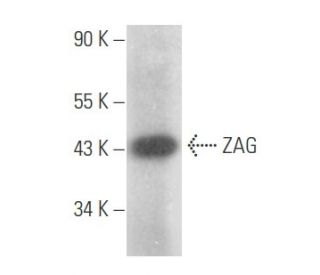 ZAG Antibody (1E2) - Western Blotting - Image 356075 