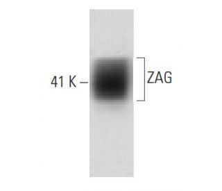 ZAG Antibody (35) - Western Blotting - Image 60496