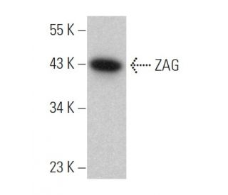 ZAG Antibody (6G2) - Western Blotting - Image 363217 