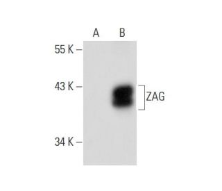 ZAG Antibody (F-4) - Western Blotting - Image 134738 