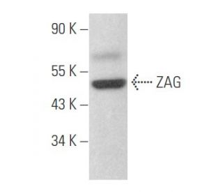 ZAG Antibody (F-9) - Western Blotting - Image 356078 