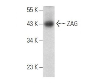 ZAG Antibody (G-8) - Western Blotting - Image 356081 