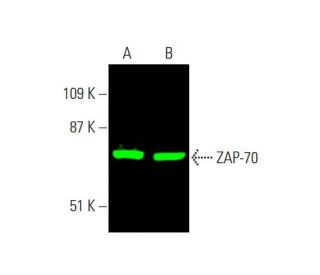 ZAP-70 Antibody (1E7.2) - Western Blotting - Image 381581 