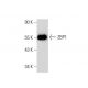 ZBP1 Antibody (H-9) - Western Blotting - Image 133411 