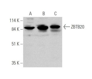 ZBTB20 Antibody (E-11) - Western Blotting - Image 346486 