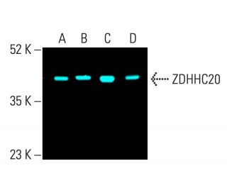 ZDHHC20 Antibody (A-4) - Western Blotting - Image 402145 