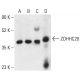 ZDHHC20 Antibody (A-4) - Western Blotting - Image 402240 