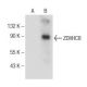 ZDHHC8 Antibody (B-3) - Western Blotting - Image 150871